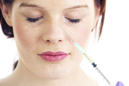 Net-chirurgesch Rhinoplastik mat Filler