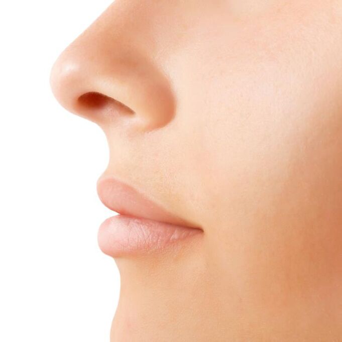 Resultat vun oppene rhinoplasty